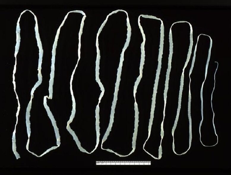 Tapeworm extracted from human gut